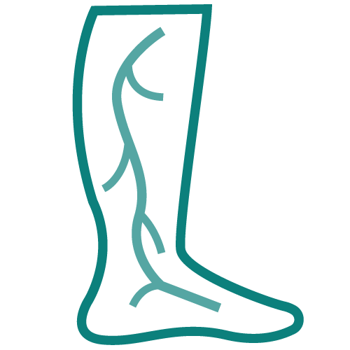 Peripheral-Vascular Peripheral-Vascular