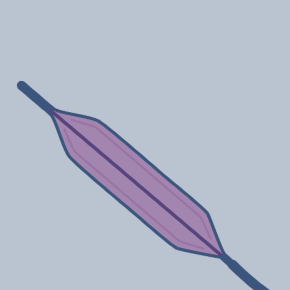 Complex balloon catheter example