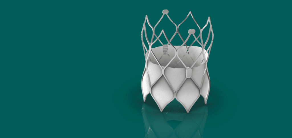 Covered stent example